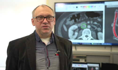 Druk 3D nadzieją onkologii. Polscy naukowcy wydrukowali trójwymiarowy model żyły zajętej nowotworem, co pozwoliło na skuteczną operację